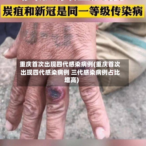 重庆首次出现四代感染病例(重庆首次出现四代感染病例 三代感染病例占比增高)
