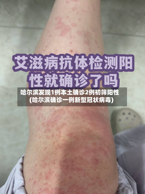 哈尔滨发现1例本土确诊2例初筛阳性(哈尔滨确诊一例新型冠状病毒)